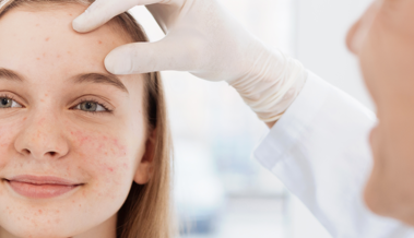 Av Acne Adolescent Dermatologue 1X1 (002) (1)