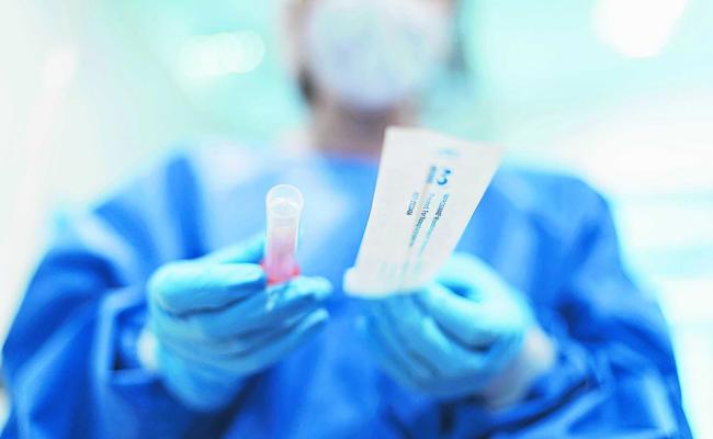 Die Coronaschnelltests sind bereits im Einsatz