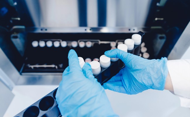 Anonyme Samenspenden: SP-Kantonrätin Karin Hasler fordert Aufarbeitung