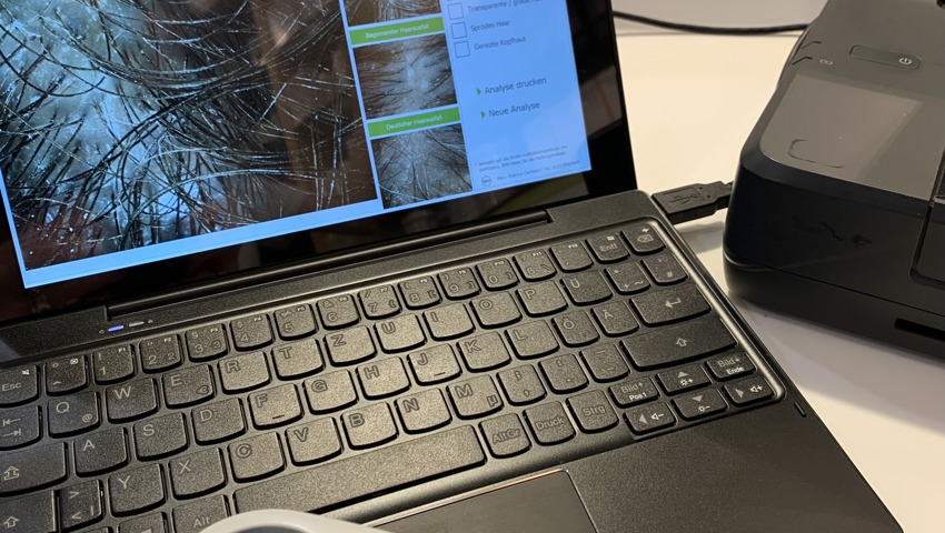 Haarausdünnung, Haarausfall und geschädigte Haarstruktur (2) Haarausdünnung, Haarausfall und geschädigte Haarstruktur (2)