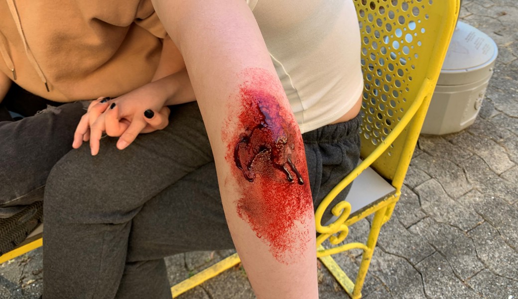 Fallbeispiel mit künstlichem Blut