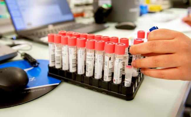 Coronalage: Zwei Todesfälle in den letzten sieben Tagen, weniger Tests